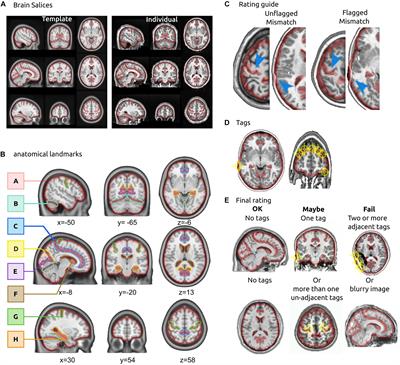 A Standardized Protocol for Efficient and Reliable Quality Control of Brain Registration in Functional MRI Studies